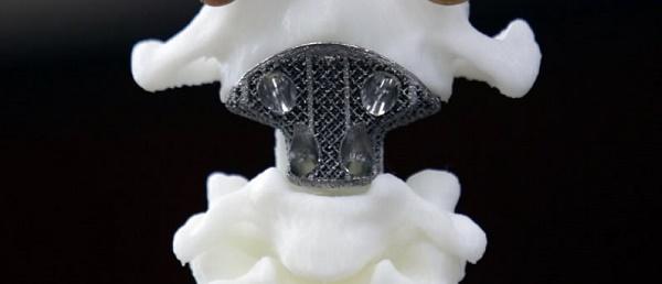 天然骨骼3D打印机，科幻技术能成为现实吗？