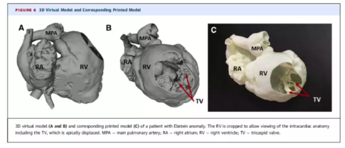 解析：3D打印技術在心衰疾病的應用方向(2)