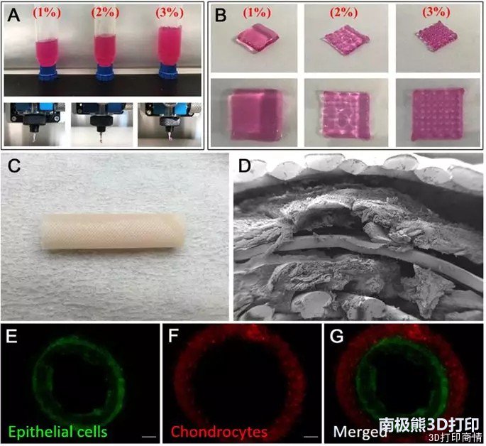 韓國(guó)研究人員用上皮細(xì)胞和軟骨細(xì)胞3D打印氣管