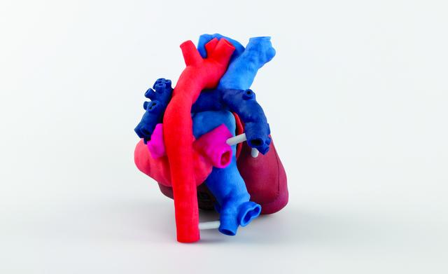 3D Systems和OpHeart为儿科心脏外科手术提供3D打印心脏模型