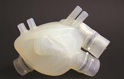 基于超声数据的3D打印技术在心脏领域的应用进展