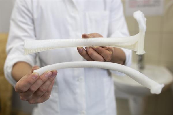 保加利亚患者接受国内首次3D打印肋骨植入术